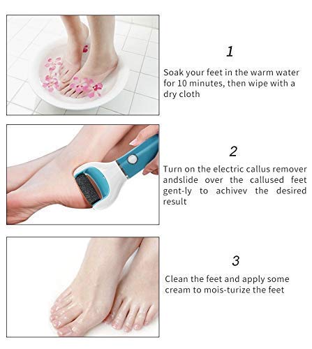 callus remover, electric callus remover, battery operated callus remover, dead skin remover, duRreey, duRreey callus remover
