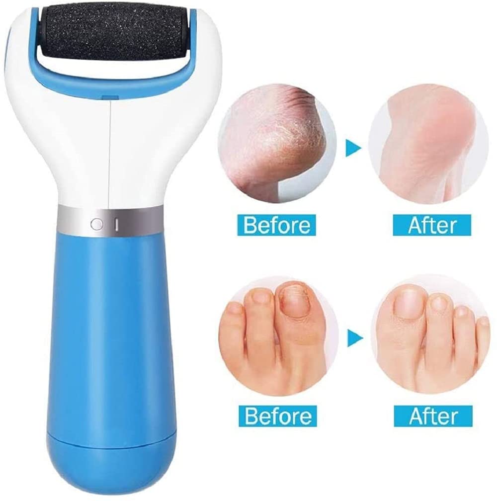 callus remover, electric callus remover, battery operated callus remover, dead skin remover, duRreey, duRreey callus remover